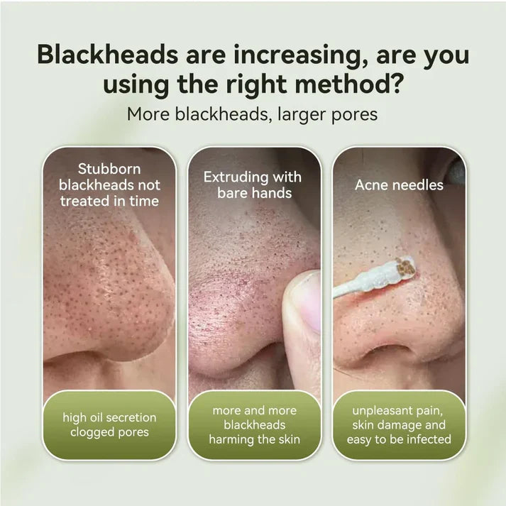 LANBENA 2.0 Blackhead Nose Plants Pore Strips(1.03 Oz), 60pcs Nose Strips for Bl